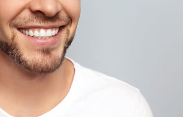 Teeth Whitening Sandton
